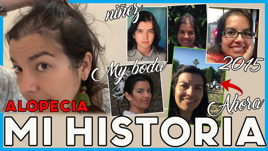 ALOPECIA FEMENINA | MI HISTORIA | MI LUCHA contra la alopecia