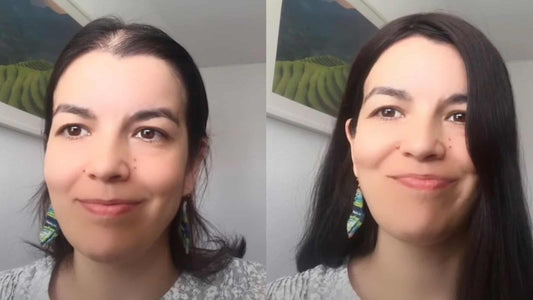 antes y después de mi prótesis capilar