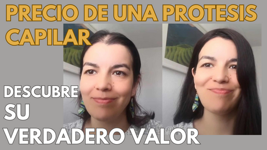 ¿Cuánto cuesta una prótesis capilar?: Precio VS Valor