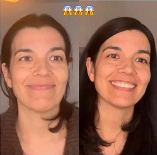 Mi primera experiencia con una prótesis capilar: Mi Hair Topper